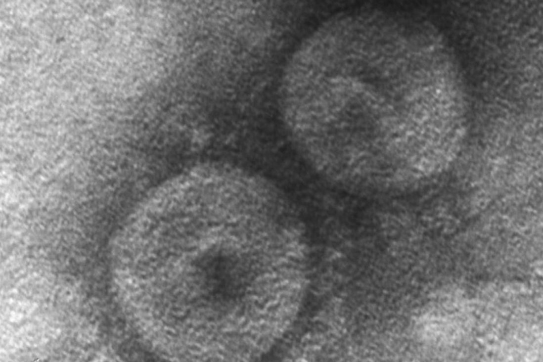 virus-corona Hồ sơ - Virus Corona chỉ gây bệnh cho chó lại xuất hiện ở người viêm phổi